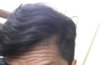 Front hair line 2.jpg