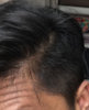 Front hair line 3.jpg