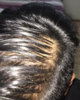 Top (wet with minoxidil) 2.jpg