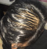 Top (wet with minoxidil) 3.jpg
