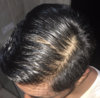 Top (wet with minoxidil) 5.jpg