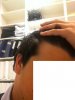 hairline1.jpg