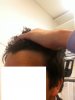 hairline2.jpg