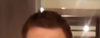 hairline.PNG