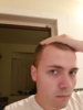 hairline 4.png
