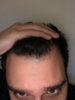Hairline Pulled Back.jpg
