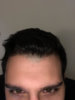 Hairline.jpg