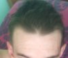 hairline3.jpg