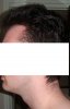 Left View Hairline.jpg