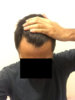 hairline2.jpg