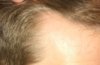 hairline-1.JPG
