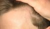 hairline-2.JPG