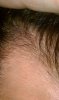 hairline now up close.jpg
