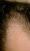 hairline now 115.jpg