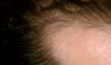 close up hairline116.jpg