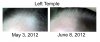 Left Temple.jpg