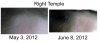 Right Temple.jpg