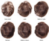 hair-density-New.jpg