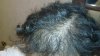 hair loss 3.jpg
