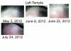 Left Temple.jpg