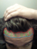 hairlinelowering.png
