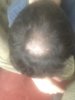 hairloss 2.jpg