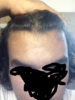 hairline.jpg