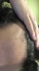 CURRENT HAIIRLINE INFLAMMATION.jpg