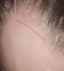 Hairline (2).PNG