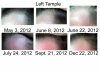 Left Temple.jpg