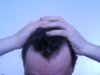 bald3.jpg bald3.jpg