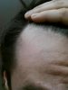 hairline 1.jpg