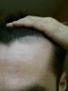 hairline 2 right.jpg
