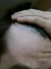 hairline 2.jpg