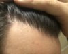 10 months hairline 1.jpg