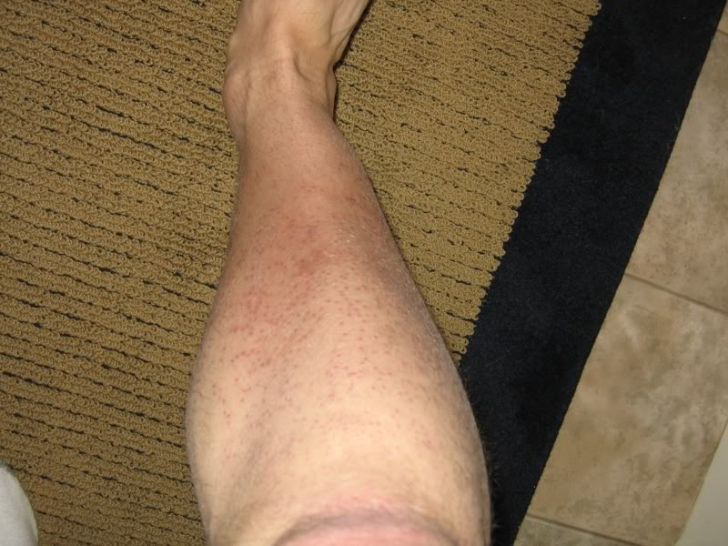 leg1-2weeks800.jpg