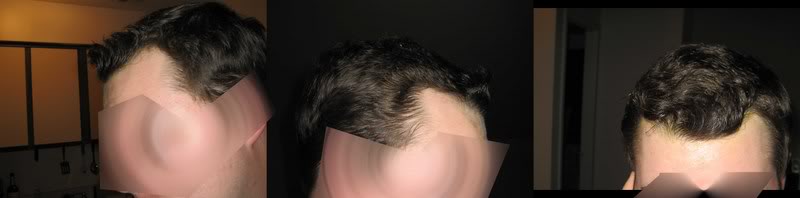 hairline2333.jpg