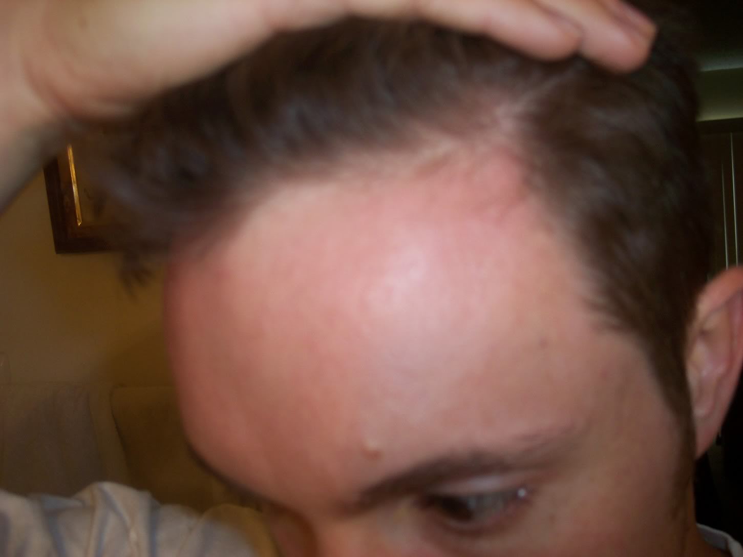 hairline.jpg
