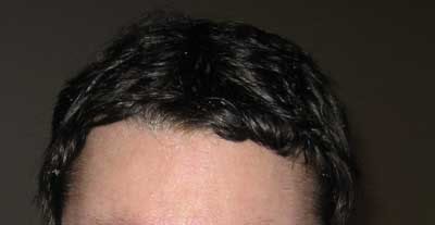 hairline-2.jpg