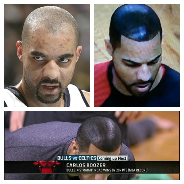 carlos-boozer-hair-3.jpg