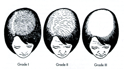 ludwig-scale.jpg