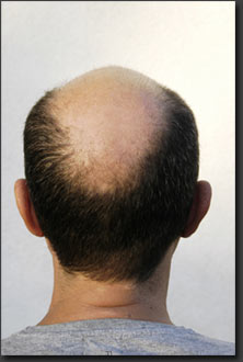 spectraldnc-hairloss.jpg