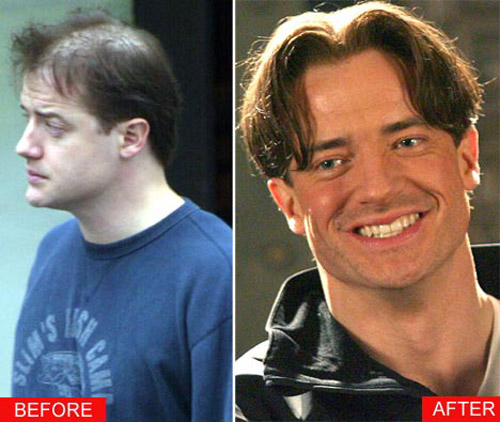 brendan-fraser-bald.jpg