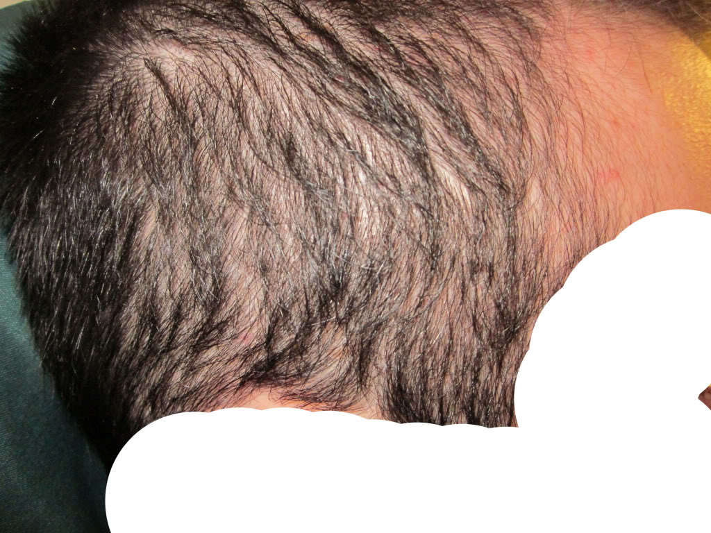 hairloss4.jpg