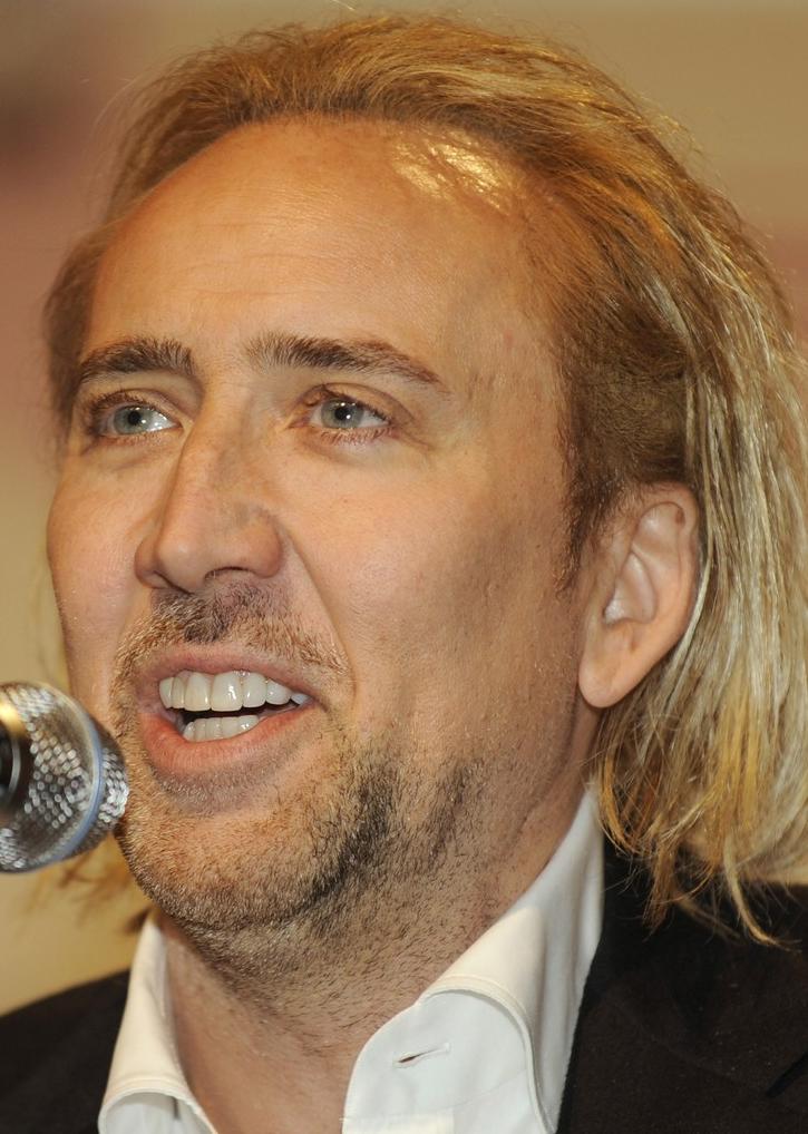 nicolas-cage-hair-transplant_zps3sbtooyg.jpg