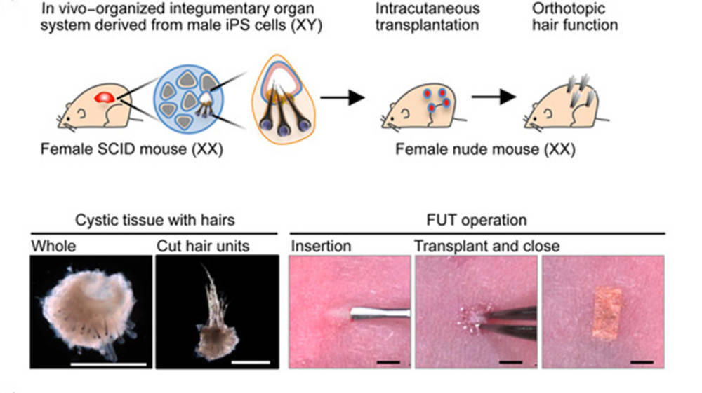 csm_transplantationpeau_51bd931099.jpg