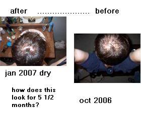 beforeandafterjan2007andoct2006.jpg
