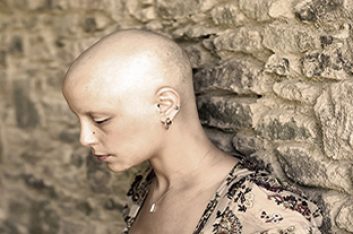 Alopecia Support