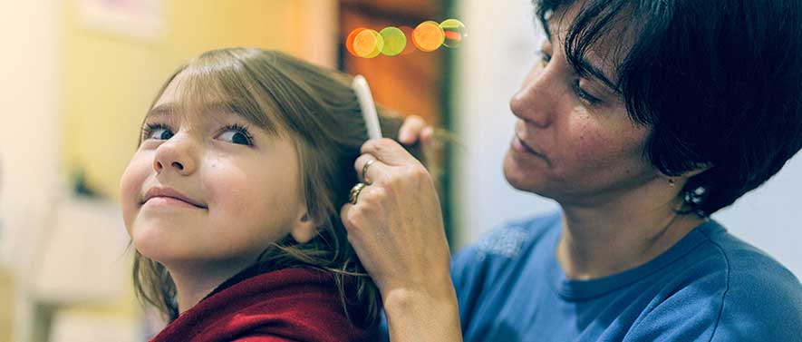 Childrens Hair Loss Treatments