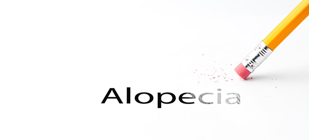 Alopecia Areata Cure?  Aclaris Therapeutics JAK3 Inhibitors.